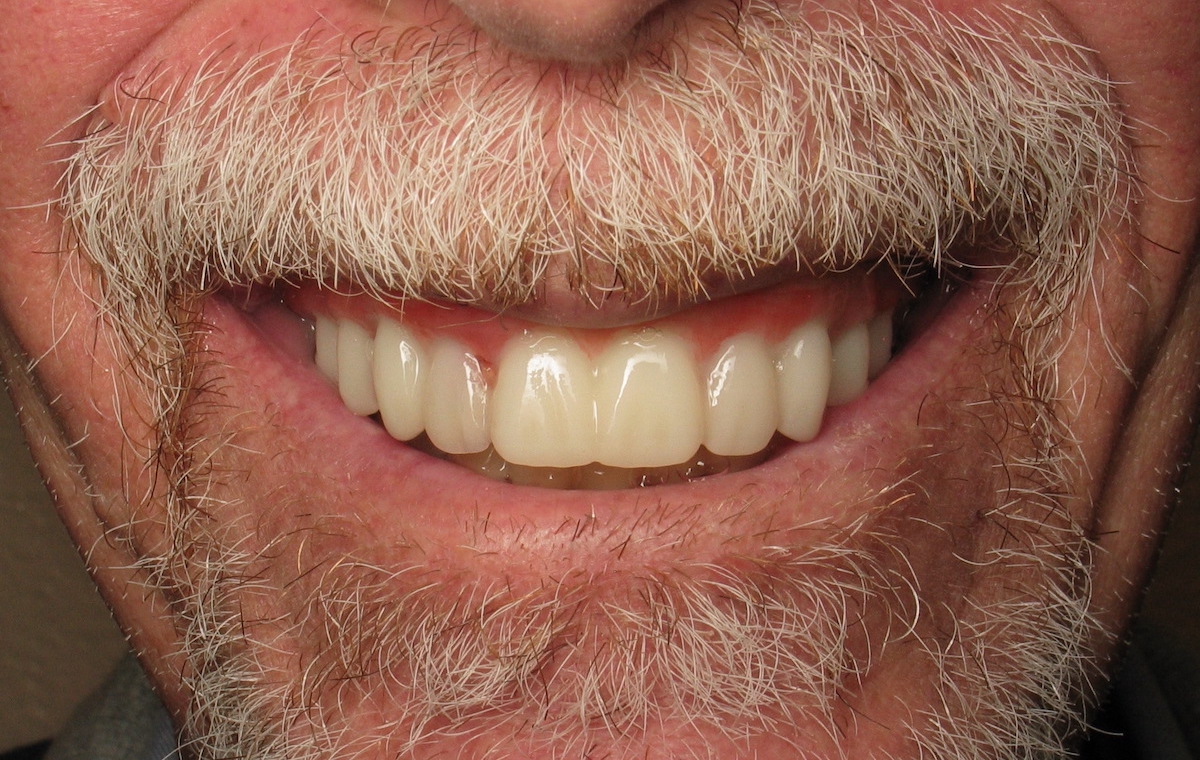 smile gallery image