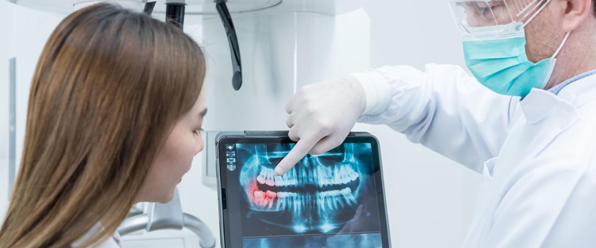 Dental diagnostics: How do digital X-rays work, and why are they done?