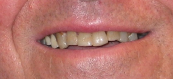 smile gallery image