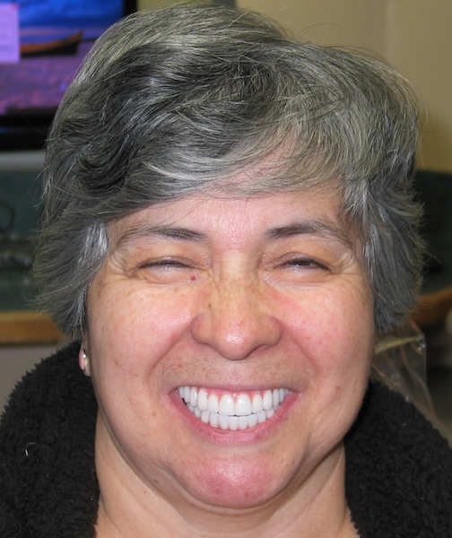 smile gallery image