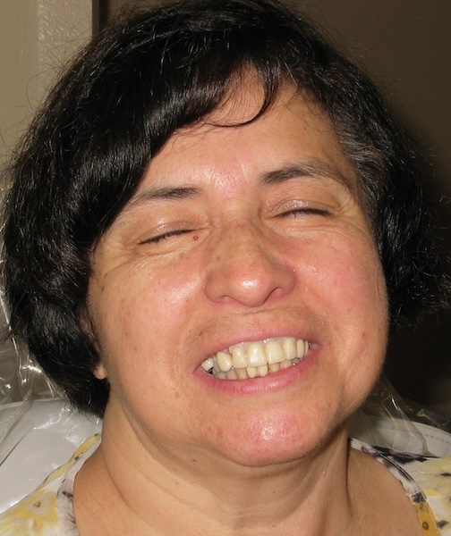 smile gallery image