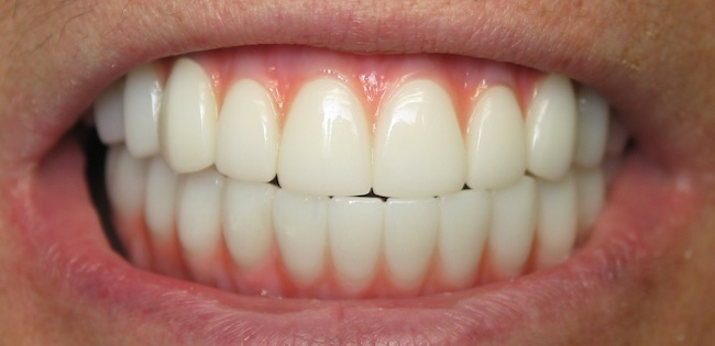 smile gallery image