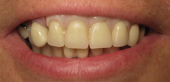 smile gallery image