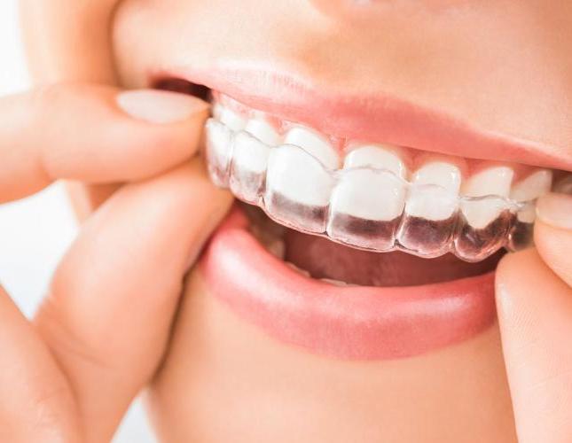 Read this if you're considering online clear aligners or other online dental products!
