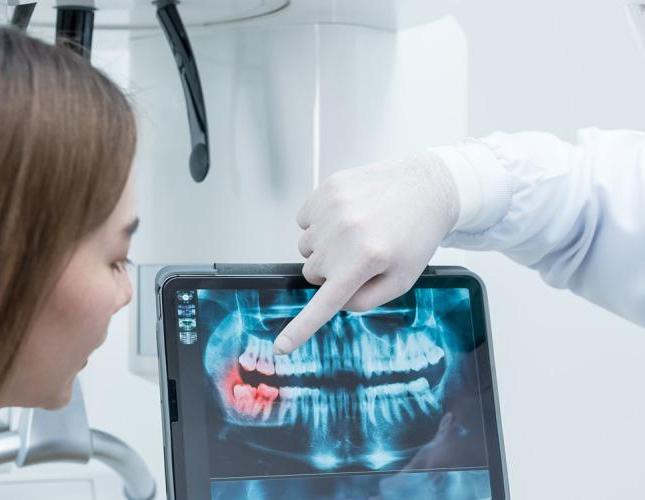 Dental diagnostics: How do digital X-rays work, and why are they done?