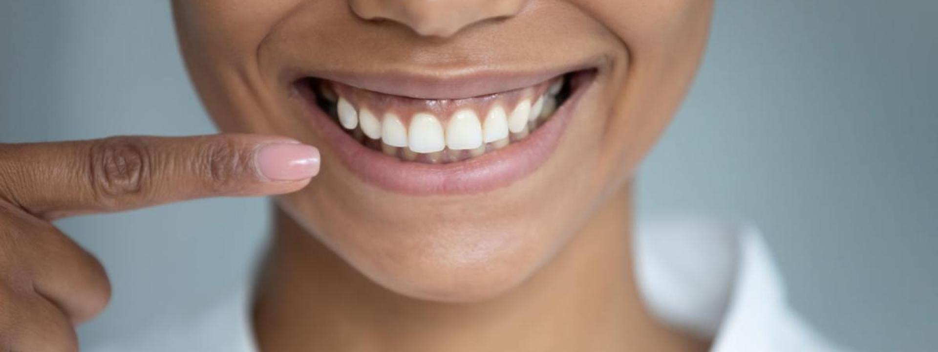 Healthy gums